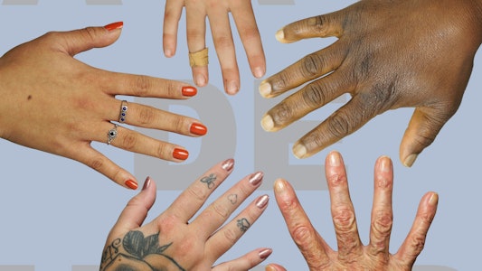 Placeholder for 220531 GG43 Aan de hand